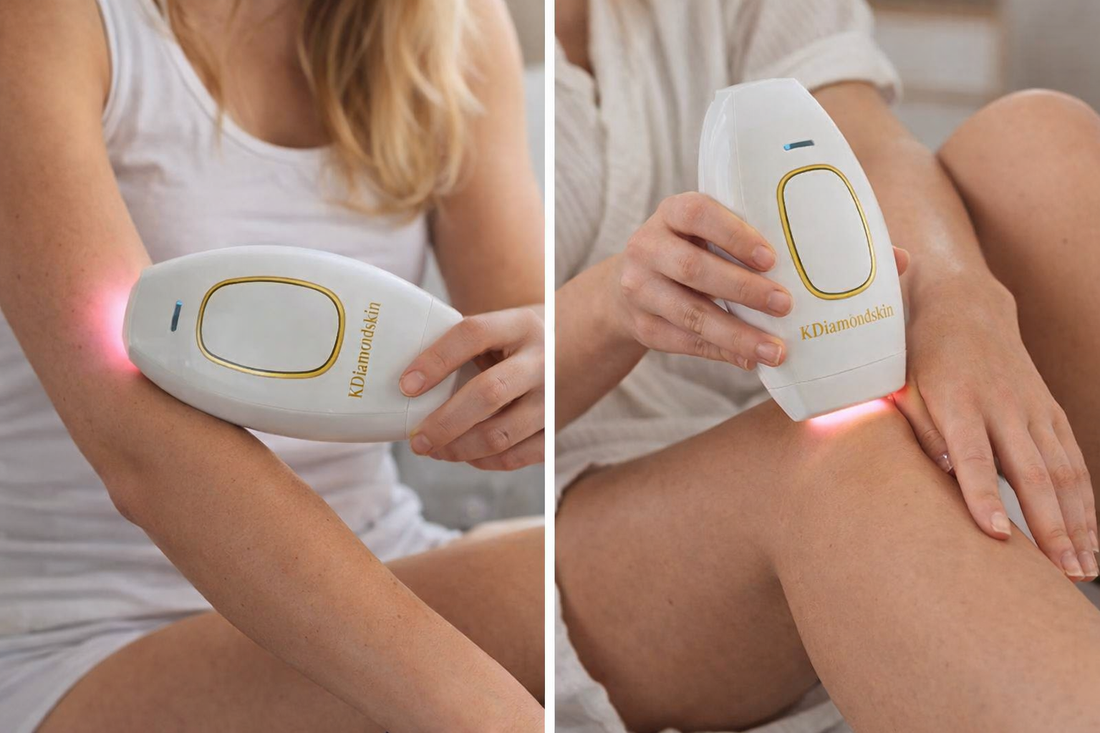 Laser hårfjerning hjemme
