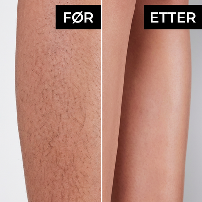 SilkX IPL Laser - Hår fjerningsapparat