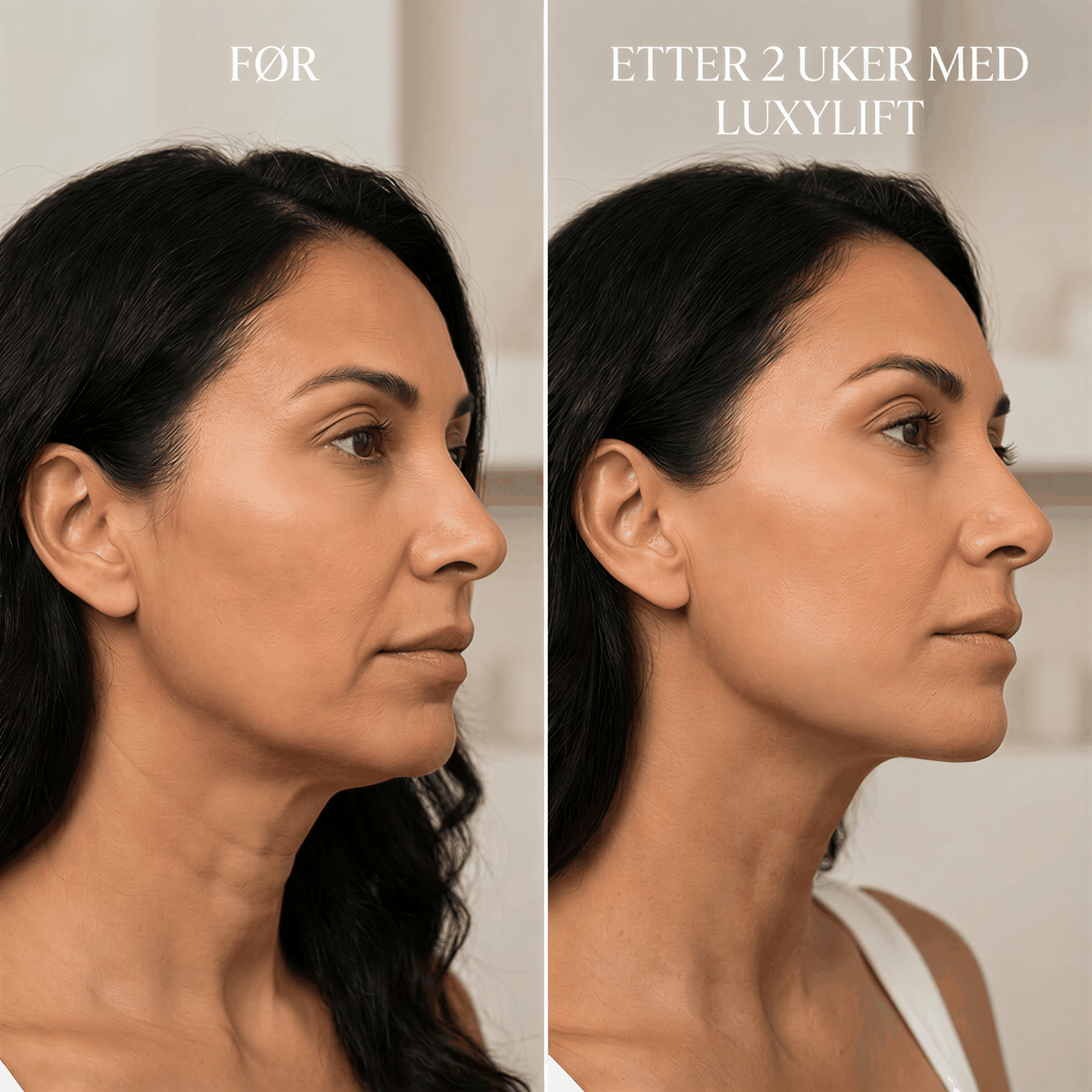 KDiamondSkin Luxylift