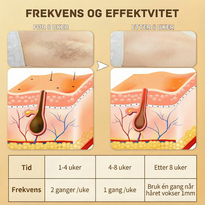SilkX IPL Laser - Hår fjerningsapparat