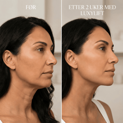 "KDiamondSkin Luxylift for selvpleie™ - KDiamondSkin