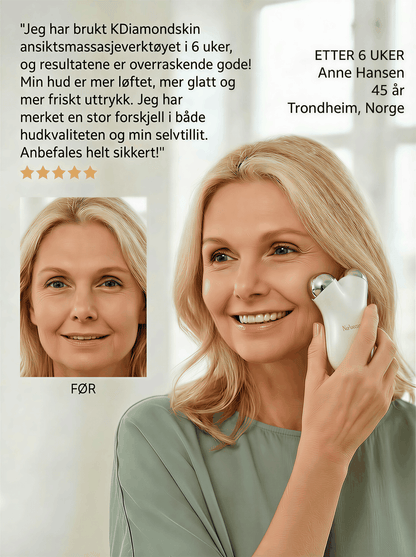 "KDiamondSkin Luxylift for selvpleie™ - KDiamondSkin