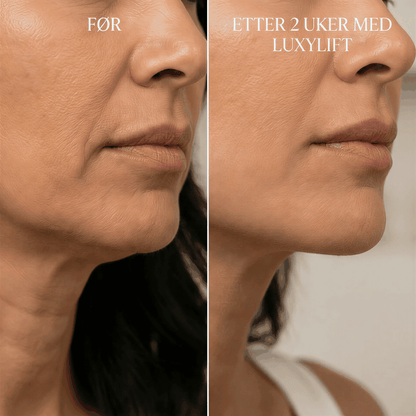 "KDiamondSkin Luxylift for selvpleie™ - KDiamondSkin