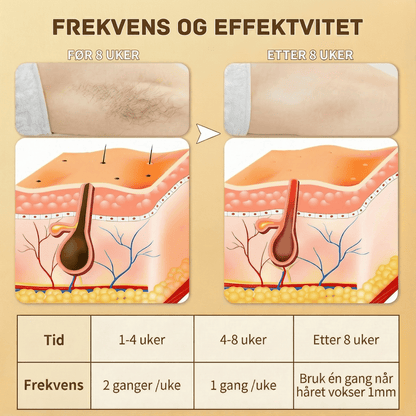 SilkX IPL Laser - Hår fjerningsapparat - KDiamondSkin