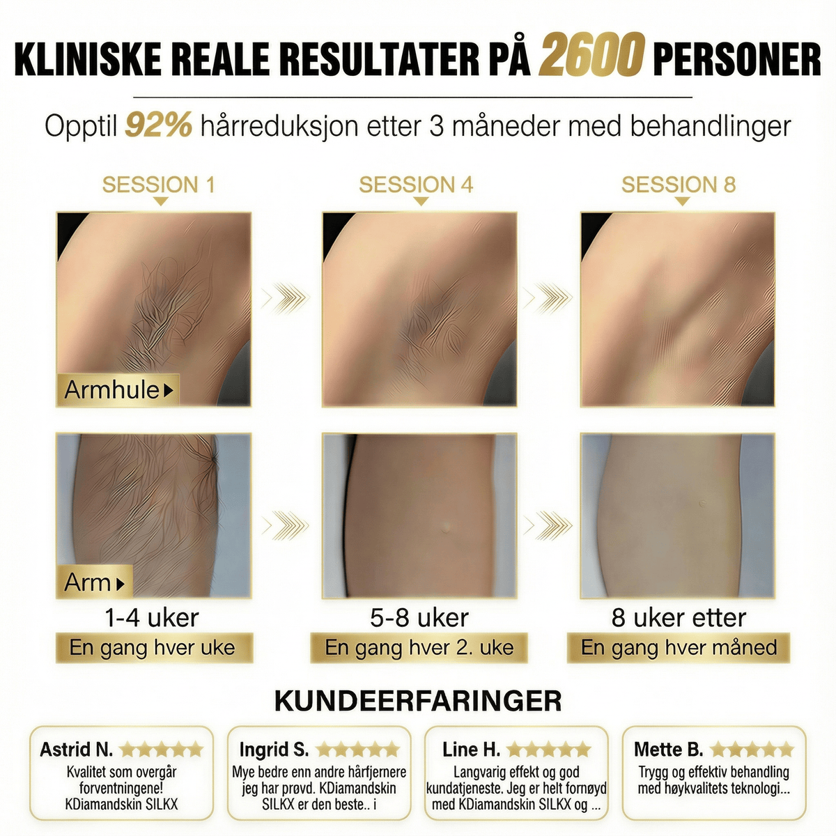 SilkX IPL Laser - Hår fjerningsapparat - KDiamondSkin