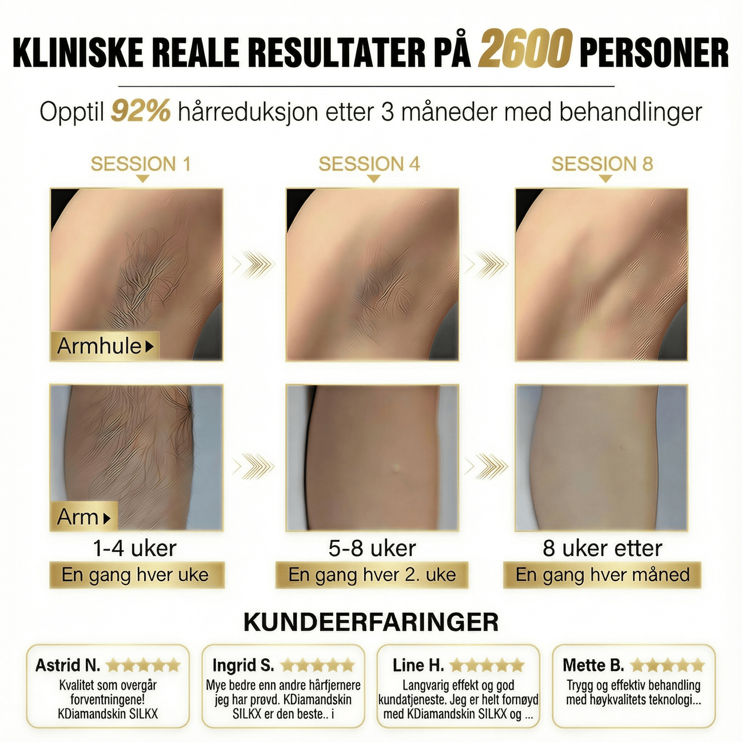 SilkX IPL Laser - Hår fjerningsapparat - KDiamondSkin